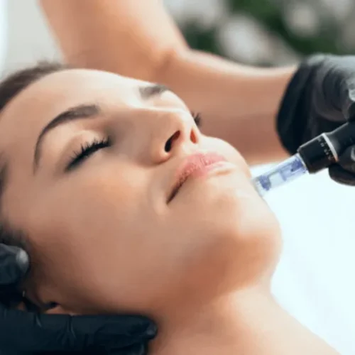 Curso de Dermapen
